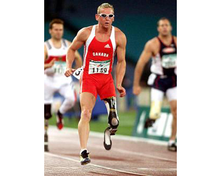 SPORT > ATLETICA LEGGERA > CORSA AMPUTATI > AUSILI